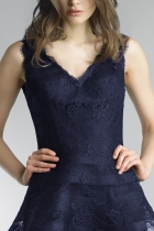 Side View