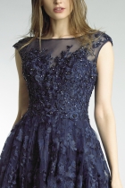 Side View