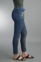 Side View