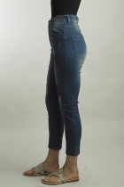 Side View