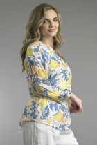 Side View